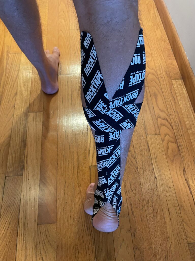 the back of a leg shows taping of the calf muscle